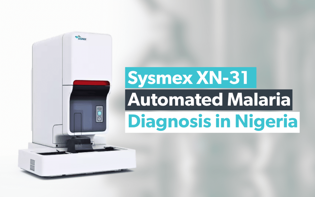 Sysmex XN-31: Automated Malaria Diagnosis in Nigeria