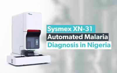 Sysmex XN-31: Automated Malaria Diagnosis in Nigeria